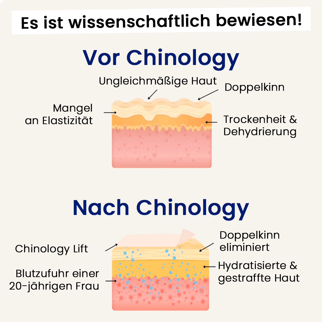 Der Chinology™ Lift