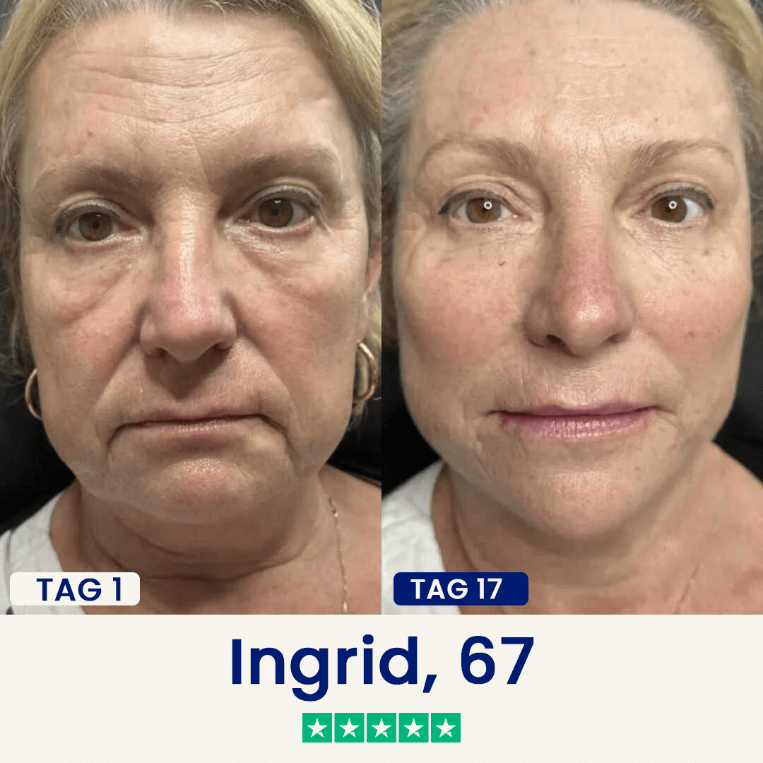 Der Chinology™ Lift