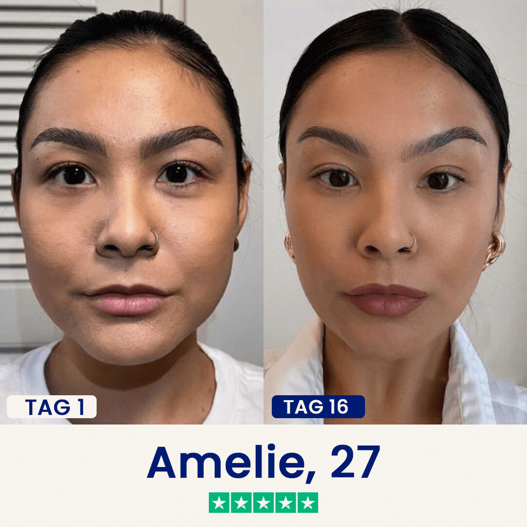 Der Chinology™ Lift