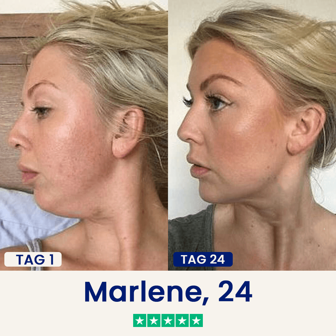 Der Chinology™ Lift